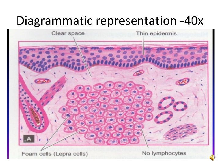 Diagrammatic representation -40 x 