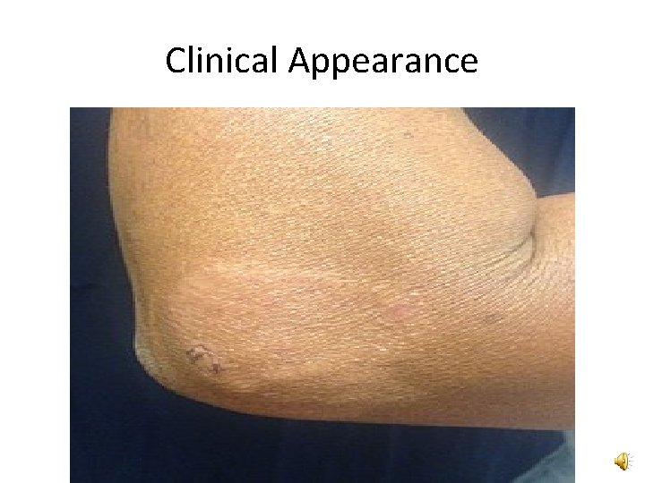 Clinical Appearance 