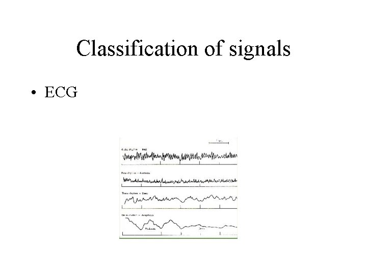 Classification of signals • ECG Classification of signals • ECG