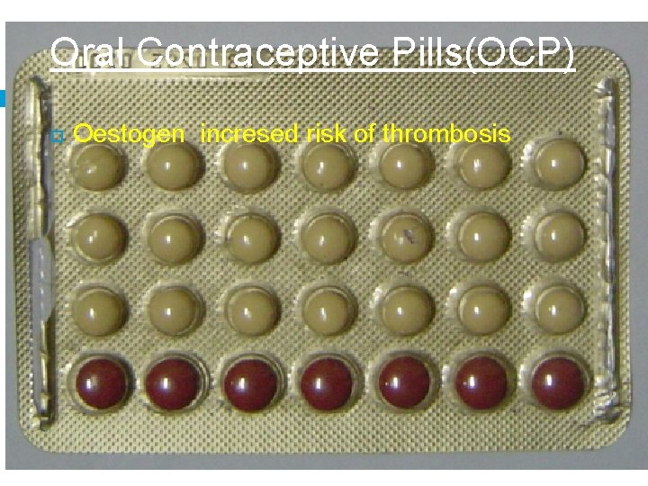 Oral Contraceptive Pills(OCP) Oestogen incresed risk of thrombosis 