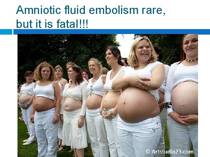 Amniotic fluid embolism rare, but it is fatal!!! 