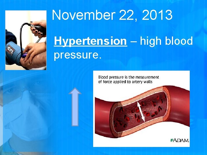 November 22, 2013 Hypertension – high blood pressure. 