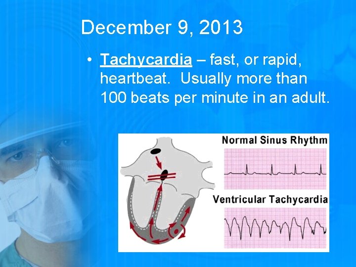 December 9, 2013 • Tachycardia – fast, or rapid, heartbeat. Usually more than 100
