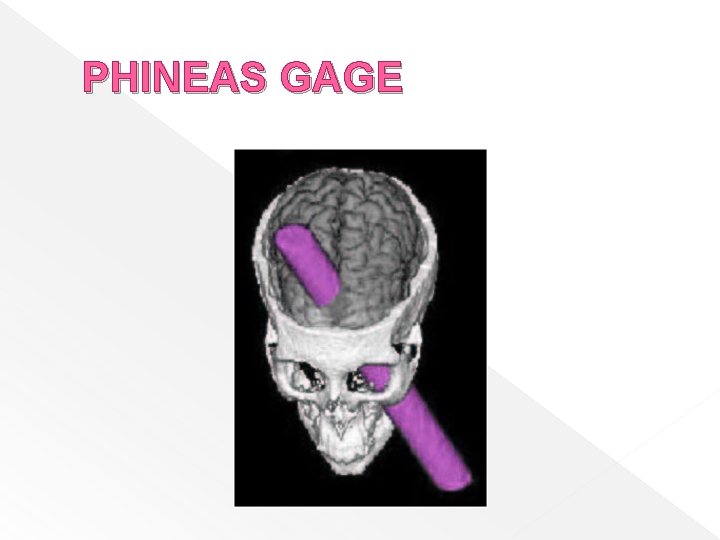 PHINEAS GAGE 