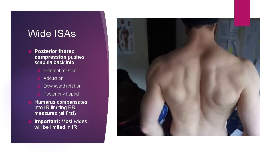 Wide ISAs Posterior thorax compression pushes scapula back into: External rotation Adduction Downward rotation