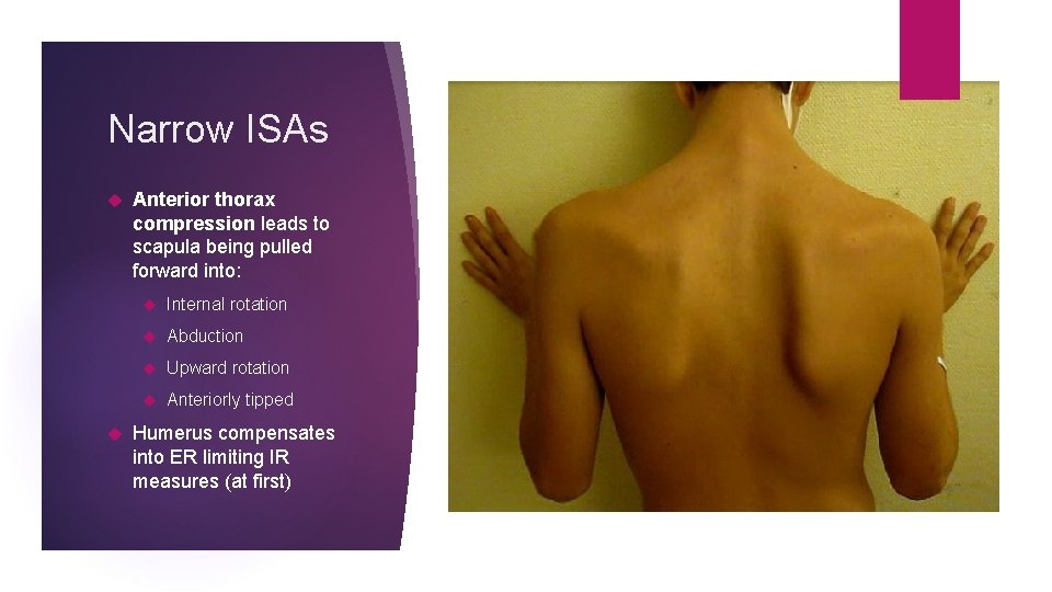 Narrow ISAs Anterior thorax compression leads to scapula being pulled forward into: Internal rotation