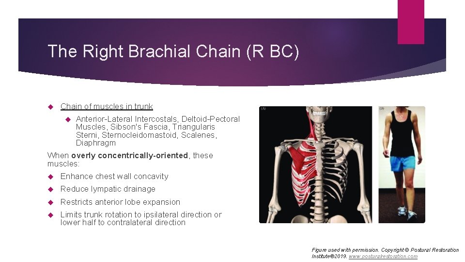The Right Brachial Chain (R BC) Chain of muscles in trunk Anterior-Lateral Intercostals, Deltoid-Pectoral