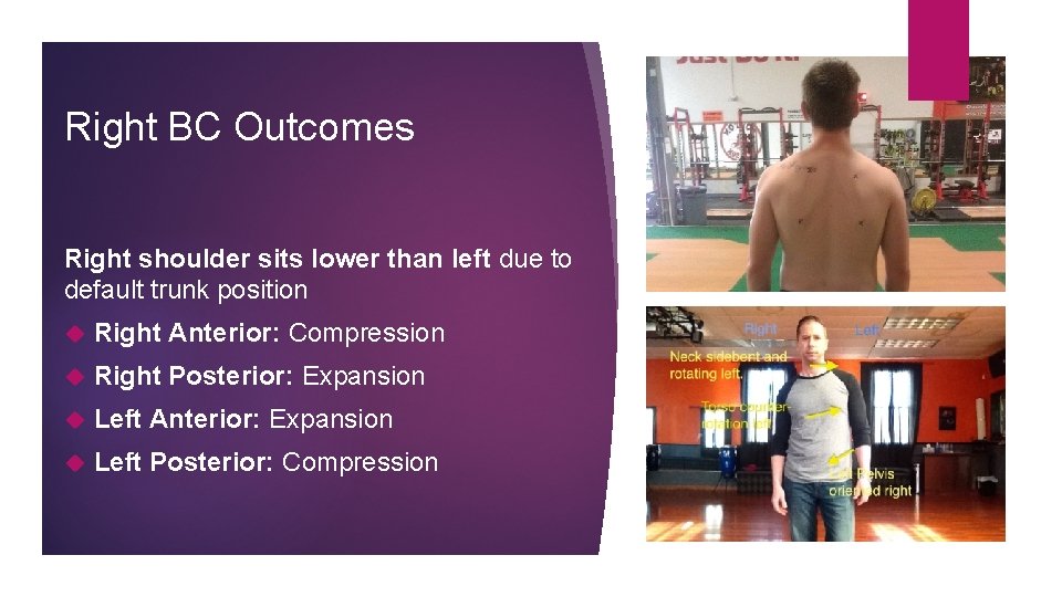 Right BC Outcomes Right shoulder sits lower than left due to default trunk position