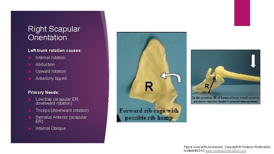 Right Scapular Orientation Left trunk rotation causes: Internal rotation Abduction Upward rotation Anteriorly tipped