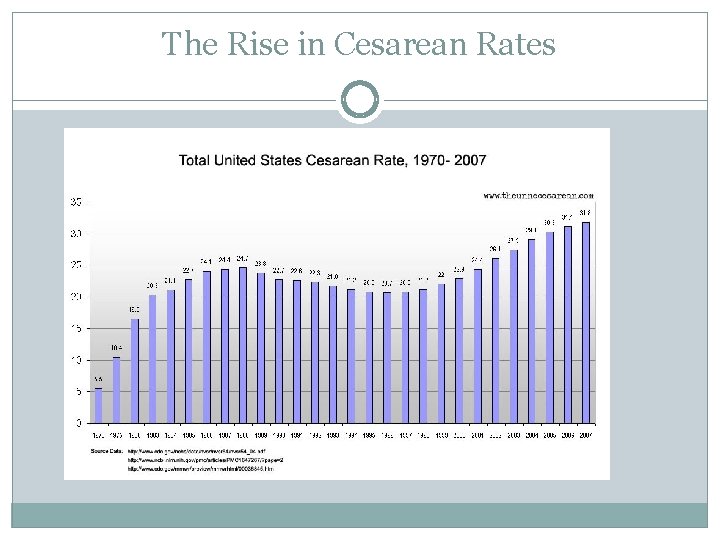 The Rise in Cesarean Rates 