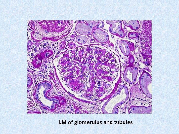 LM of glomerulus and tubules 