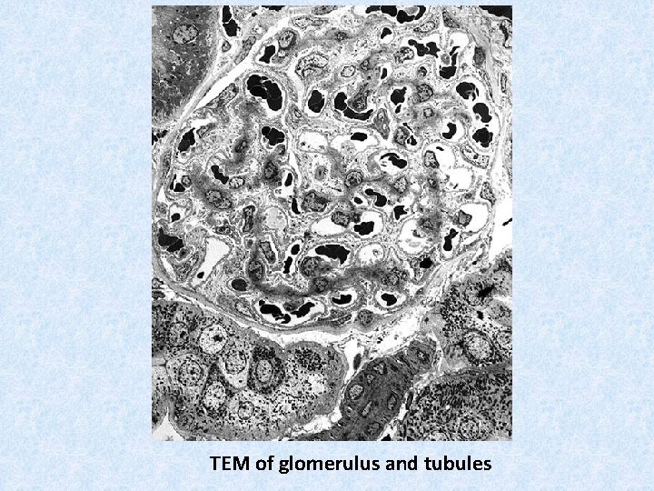 TEM of glomerulus and tubules 