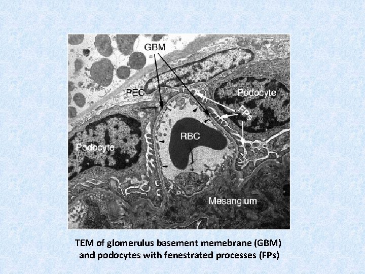 TEM of glomerulus basement memebrane (GBM) and podocytes with fenestrated processes (FPs) 