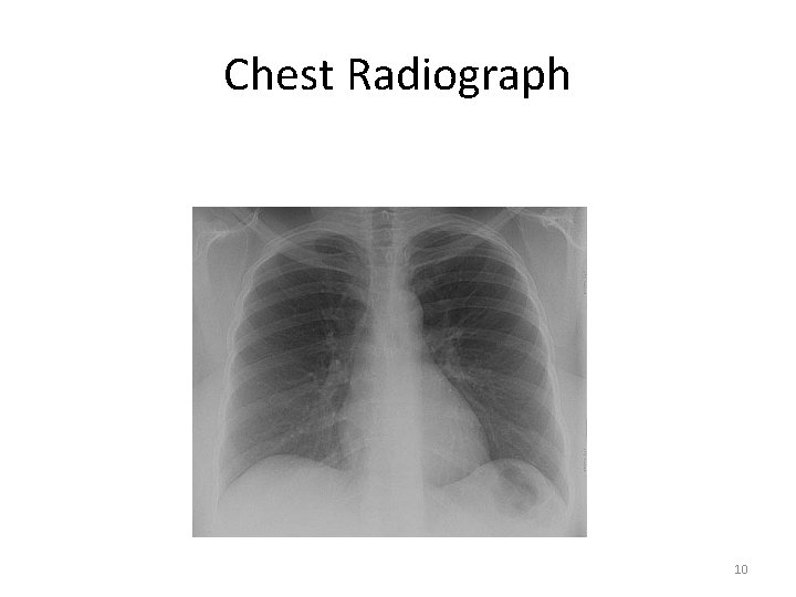 Chest Radiograph 10 Chest Radiograph 10