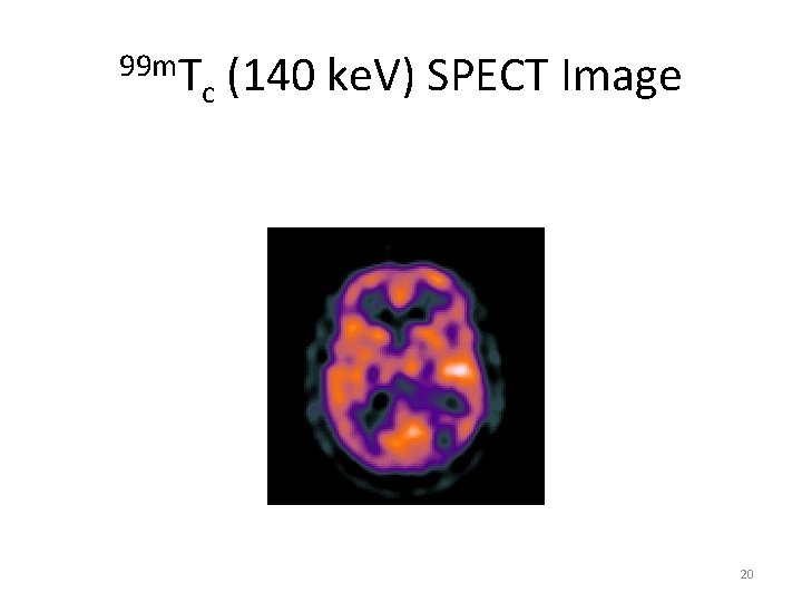 99 m. T c (140 ke. V) SPECT Image 20 99 m. T c (140 ke. V) SPECT Image 20