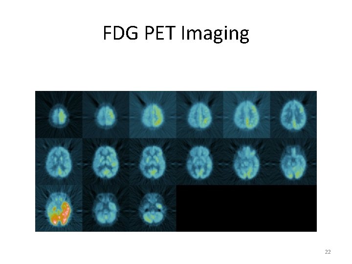 FDG PET Imaging 22 FDG PET Imaging 22