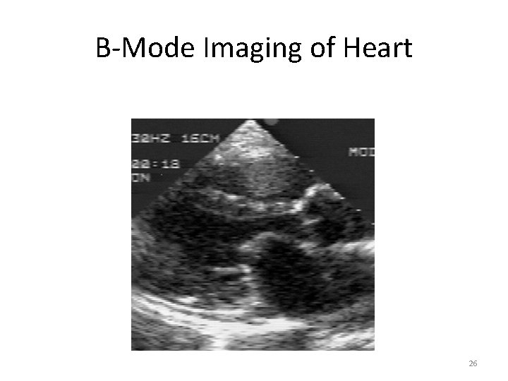 B-Mode Imaging of Heart 26 B-Mode Imaging of Heart 26