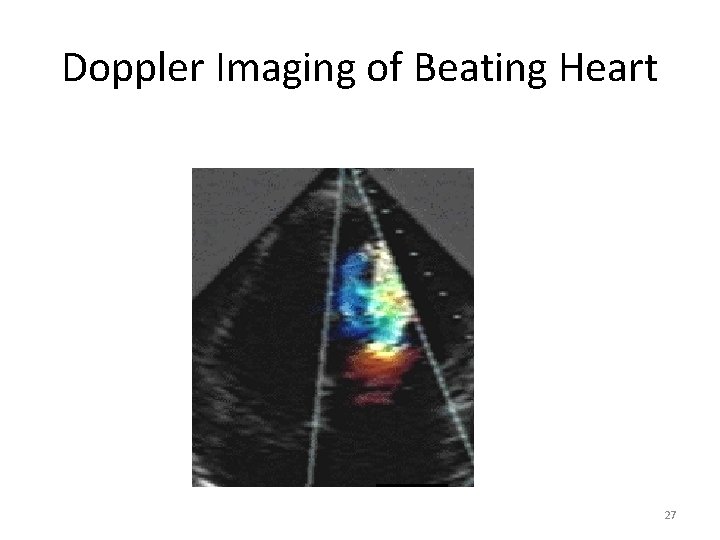 Doppler Imaging of Beating Heart 27 Doppler Imaging of Beating Heart 27