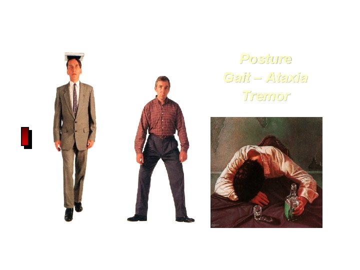 Posture Gait – Ataxia Tremor 