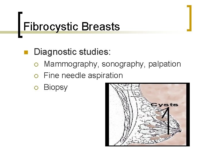 Fibrocystic Breasts n Diagnostic studies: ¡ ¡ ¡ Mammography, sonography, palpation Fine needle aspiration