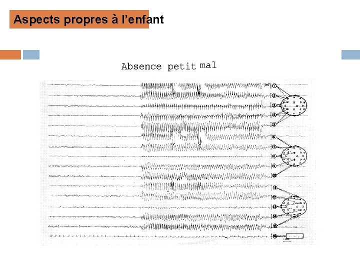 Aspects propres à l’enfant 