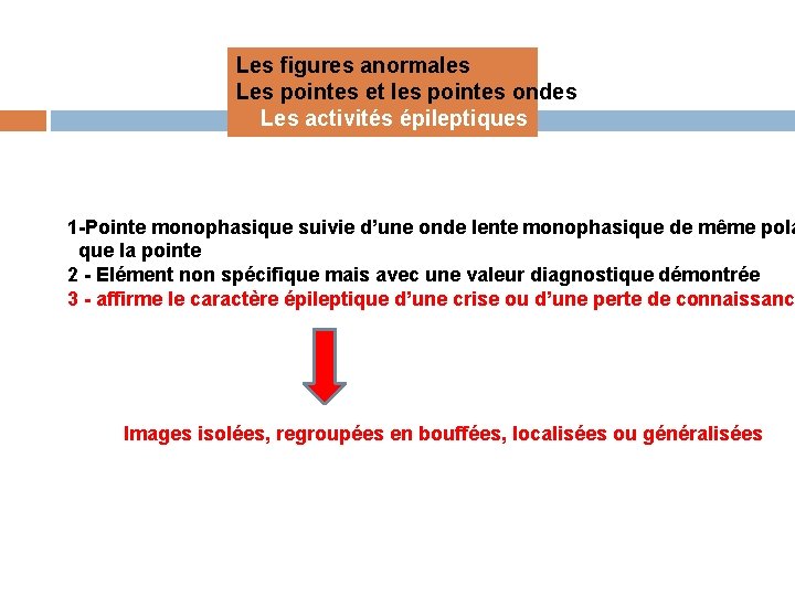 Les figures anormales Les pointes et les pointes ondes Les activités épileptiques 1 -Pointe