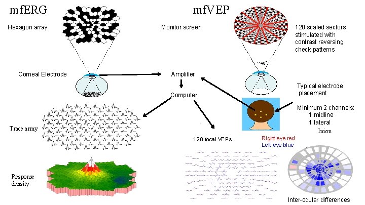 mf. ERG Hexagon array mf. VEP Monitor screen 120 scaled sectors stimulated with contrast