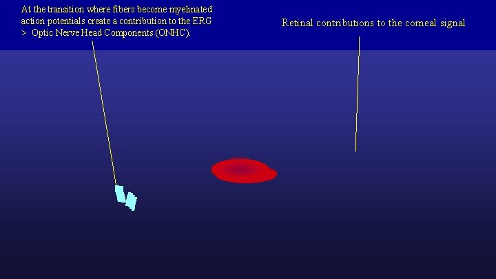 At the transition where fibers become myelinated action potentials create a contribution to the