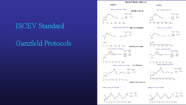 ISCEV Standard Ganzfeld Protocols 