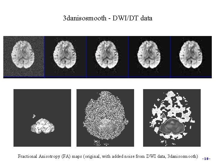 3 danisosmooth - DWI/DT data Fractional Anisotropy (FA) maps (original, with added noise from