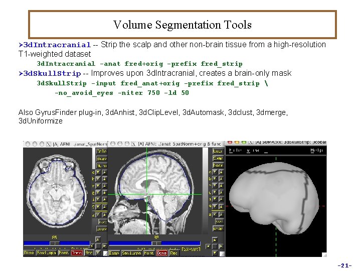 Volume Segmentation Tools Ø 3 d. Intracranial -- Strip the scalp and other non-brain