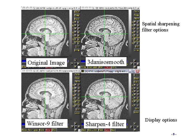 Spatial sharpening filter options Original Image Winsor-9 filter 3 danisosmooth Sharpen-4 filter Display options