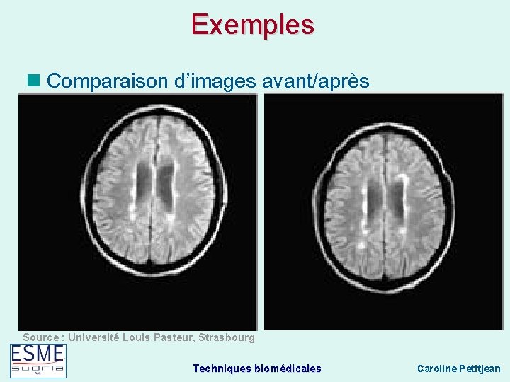 Exemples Comparaison d’images avant/après Source : Université Louis Pasteur, Strasbourg Techniques biomédicales Caroline Petitjean
