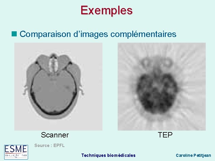 Exemples Comparaison d’images complémentaires Scanner TEP Source : EPFL Techniques biomédicales Caroline Petitjean 