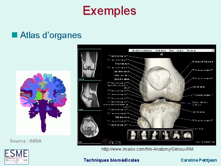 Exemples Atlas d’organes Source : INRIA http: //www. imaios. com/fr/e-Anatomy/Genou-IRM Techniques biomédicales Caroline Petitjean