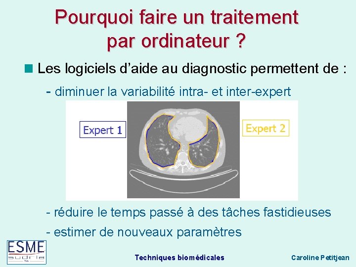 Pourquoi faire un traitement par ordinateur ? Les logiciels d’aide au diagnostic permettent de