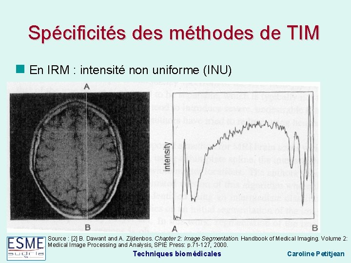 Spécificités des méthodes de TIM En IRM : intensité non uniforme (INU) Source :