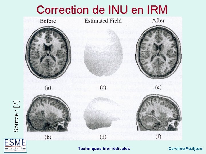 Source : [2] Correction de INU en IRM Techniques biomédicales Caroline Petitjean 