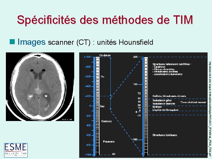 Spécificités des méthodes de TIM Images scanner (CT) : unités Hounsfield Caroline Petitjean http: