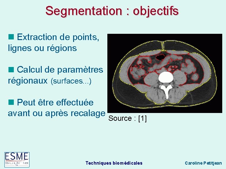 Segmentation : objectifs Extraction de points, lignes ou régions Calcul de paramètres régionaux (surfaces.
