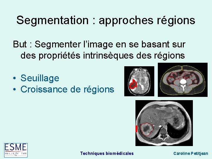 Segmentation : approches régions But : Segmenter l’image en se basant sur des propriétés
