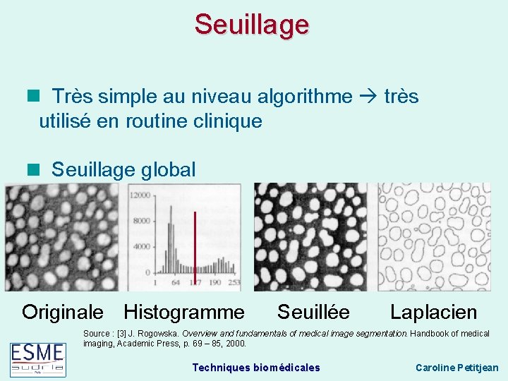 Seuillage Très simple au niveau algorithme très utilisé en routine clinique Seuillage global Originale
