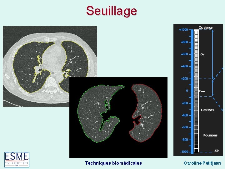 Seuillage Techniques biomédicales Caroline Petitjean 