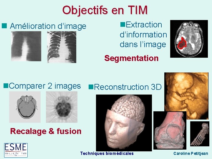 Objectifs en TIM Amélioration d’image Extraction d’information dans l’image Segmentation Comparer 2 images Reconstruction