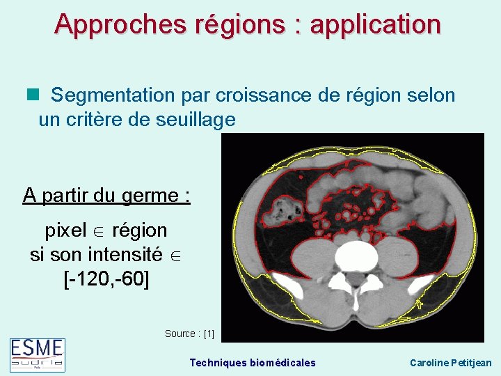 Approches régions : application Segmentation par croissance de région selon un critère de seuillage