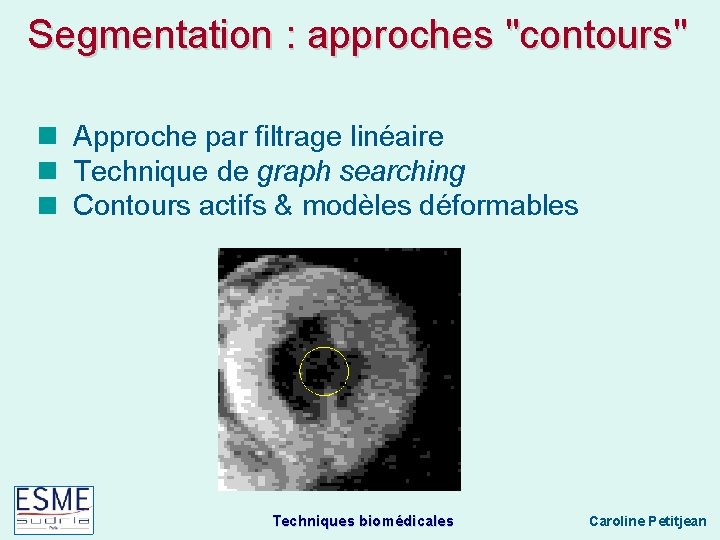 Segmentation : approches "contours" Approche par filtrage linéaire Technique de graph searching Contours actifs