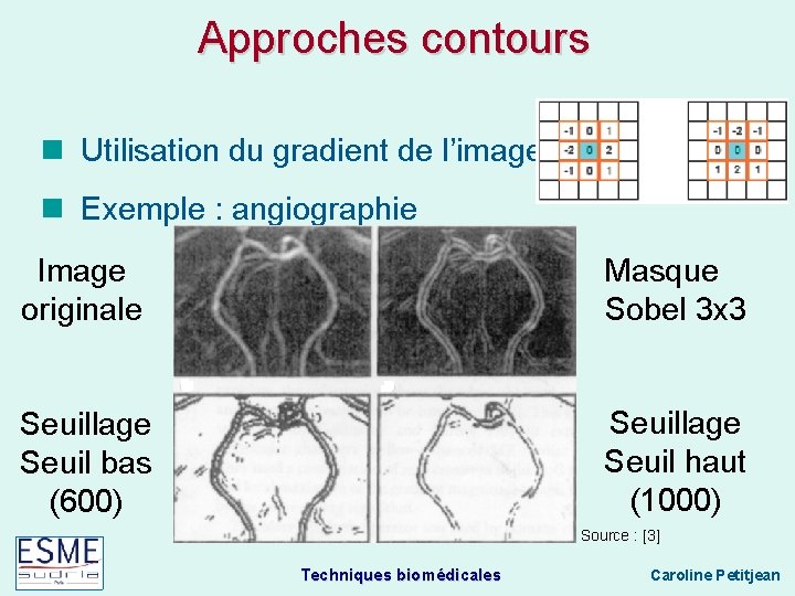 Approches contours Utilisation du gradient de l’image Exemple : angiographie Image originale Masque Sobel