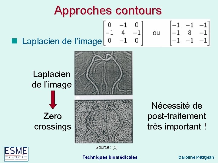 Approches contours Laplacien de l’image Nécessité de post-traitement très important ! Zero crossings Source