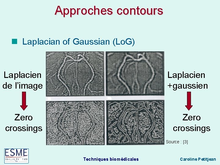 Approches contours Laplacian of Gaussian (Lo. G) Laplacien de l’image Laplacien +gaussien Zero crossings