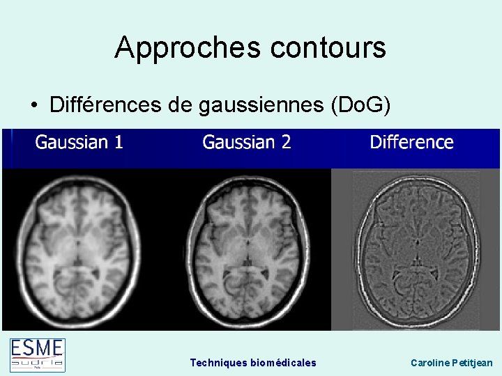 Approches contours • Différences de gaussiennes (Do. G) Techniques biomédicales Caroline Petitjean 